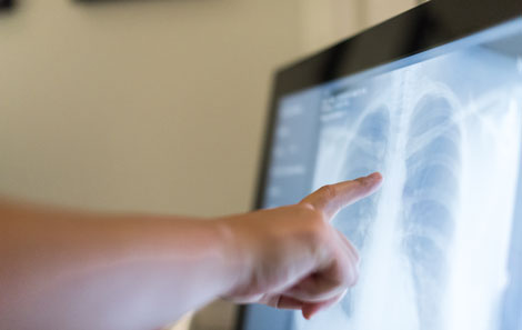 Radiologist analyzing MRI results on a computer screen.